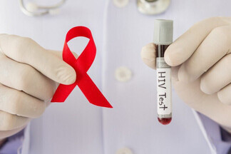 В Орджоникидзевском доступно бесплатное тестирование на ВИЧ